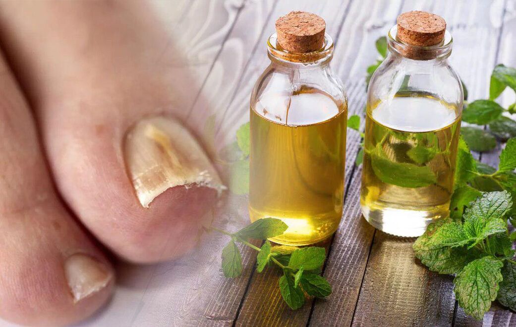 Essig gegen Nagelpilz